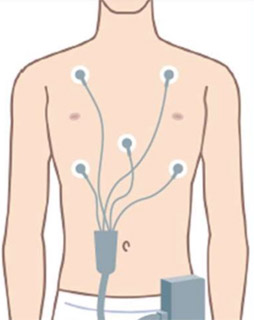 従来のホルター心電図