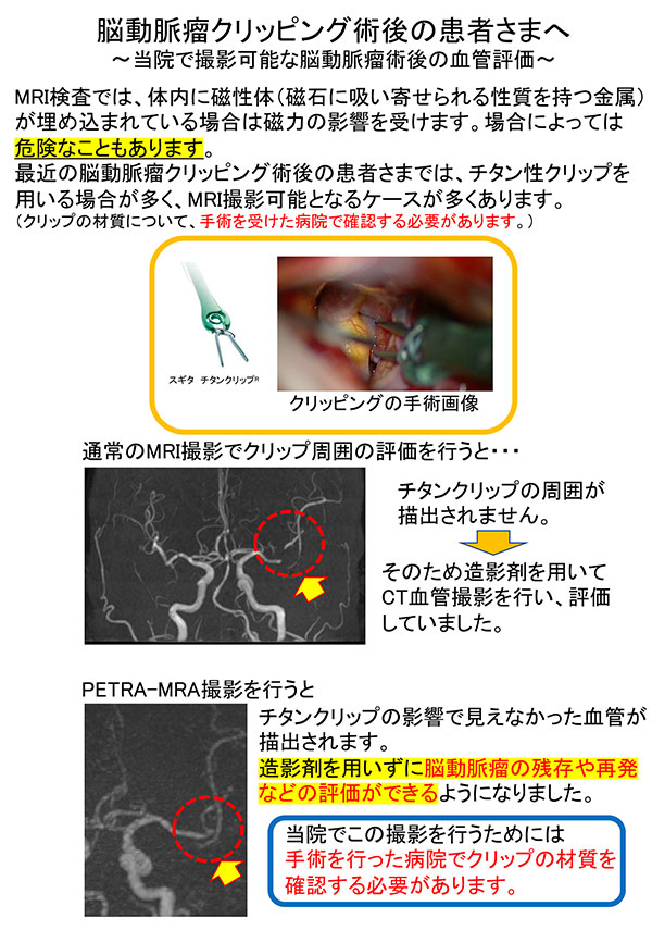 脳ドック・人間ドックのご案内