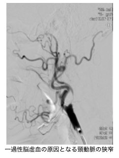 注意を要するしびれ