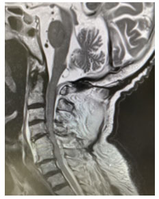 脊椎・脊髄外科